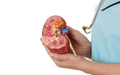 Pemeriksaan Rutin bagi Pengidap Gagal Ginjal